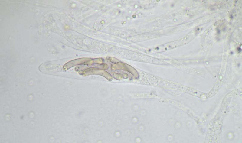 macrostoma