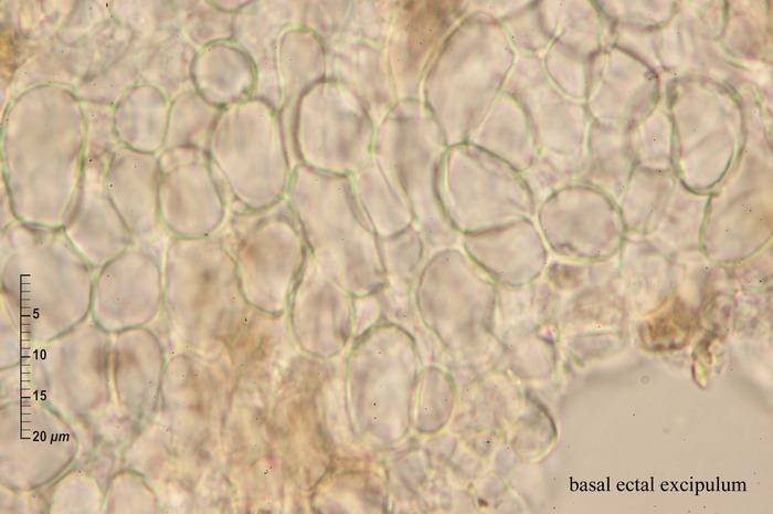 macrostoma