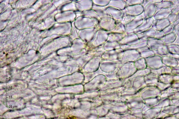 macrostoma
