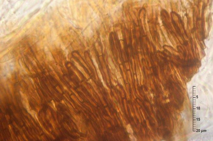 macrostoma
