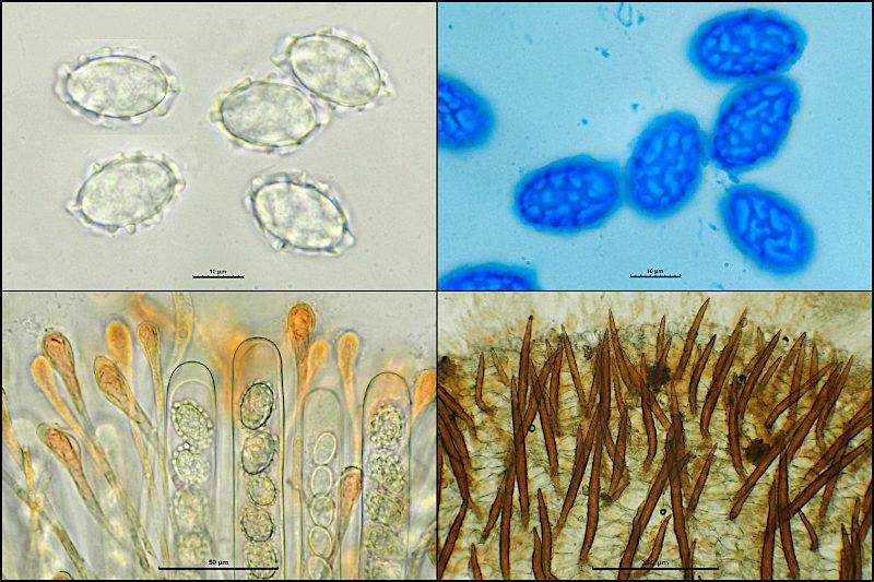 macrostoma