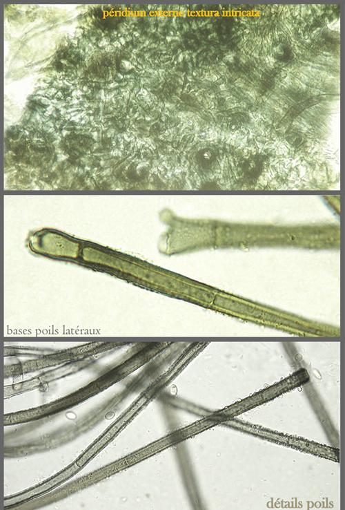 macrostoma