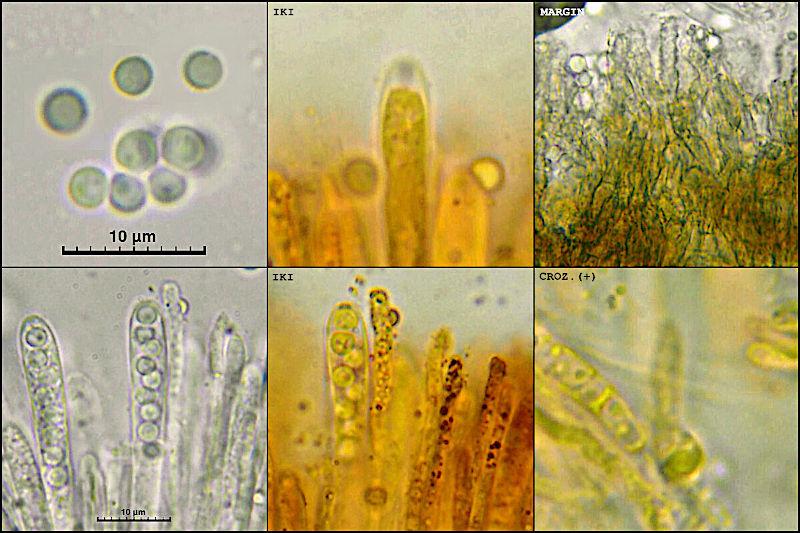 macrostoma