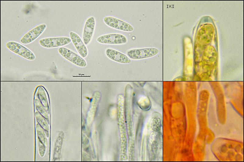 macrostoma
