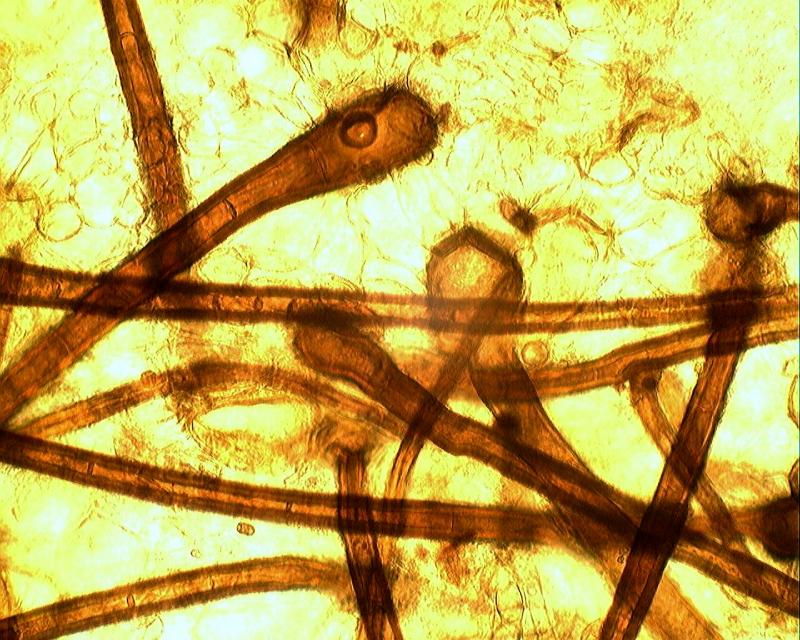 macrostoma