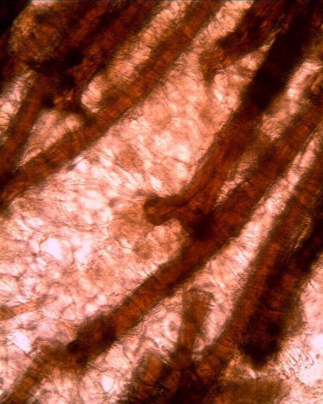 macrostoma