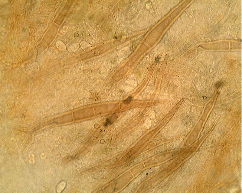 macrostoma