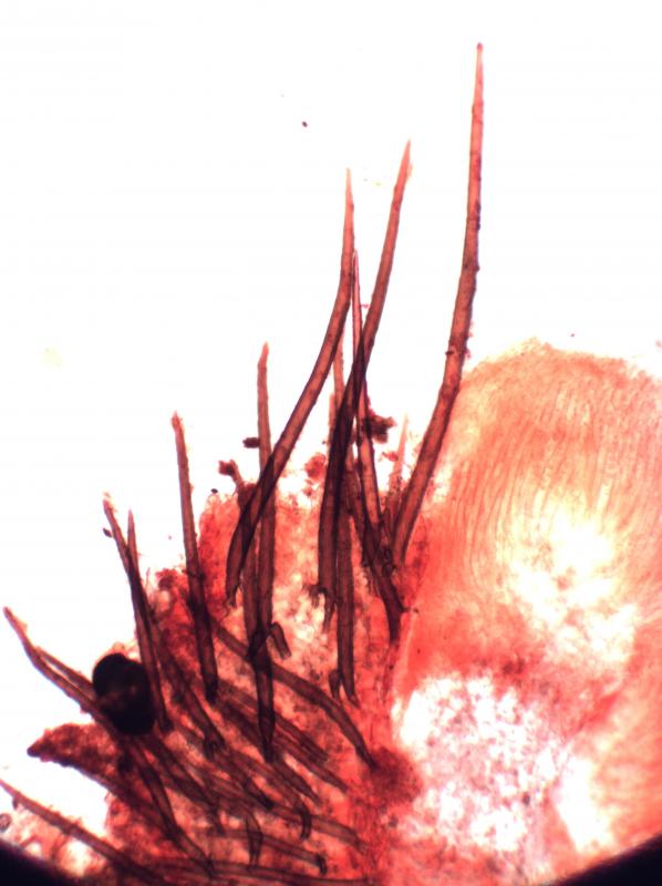 macrostoma