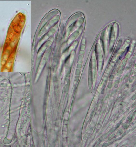 macrostoma