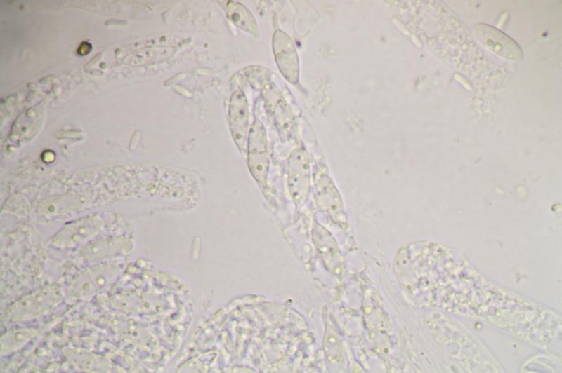 macrostoma