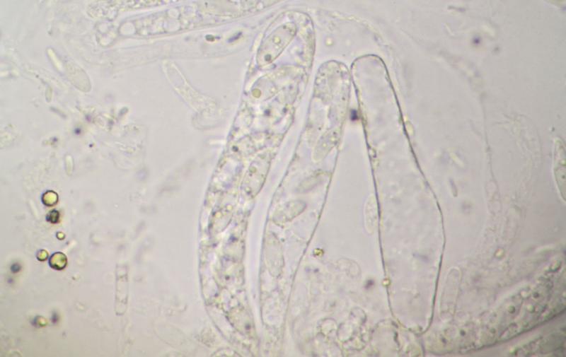 macrostoma