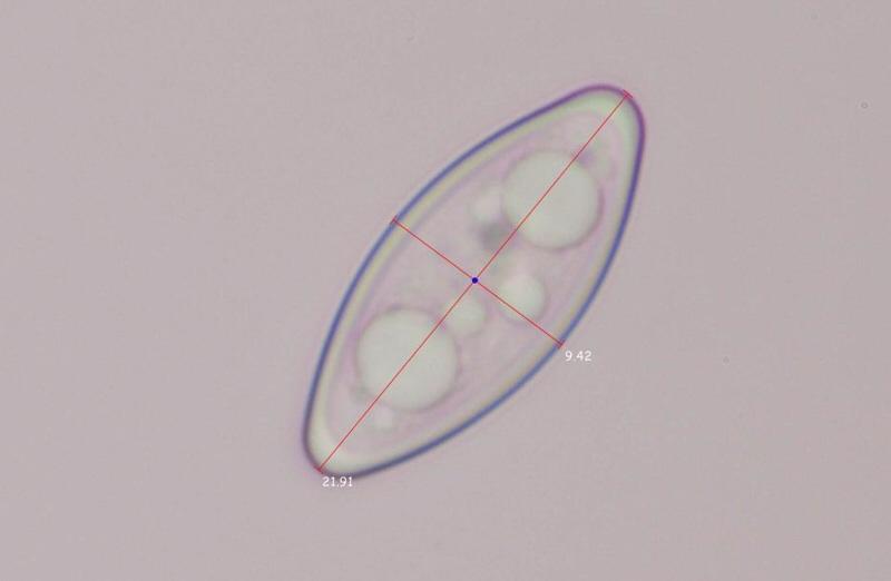 macrostoma