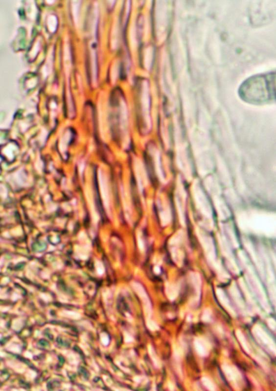 macrostoma