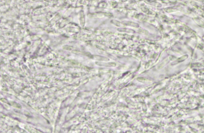 macrostoma