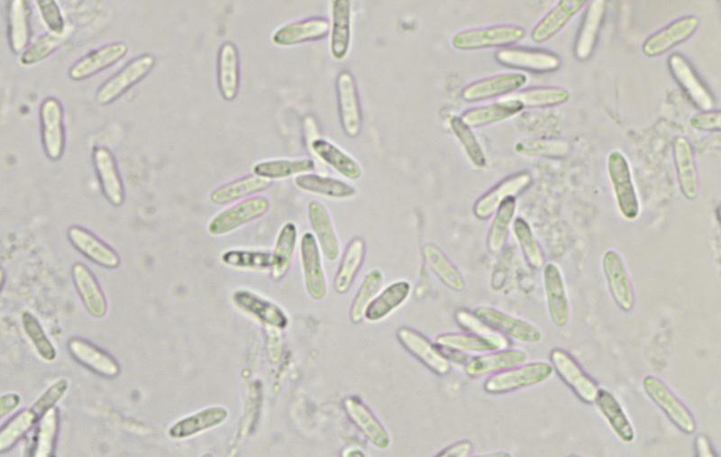 macrostoma
