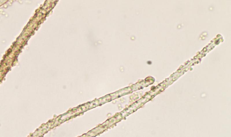 macrostoma
