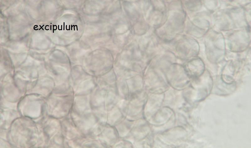 macrostoma