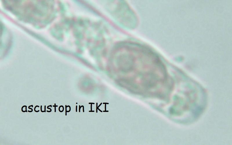 macrostoma
