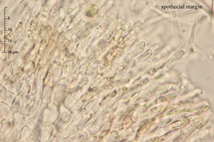 macrostoma