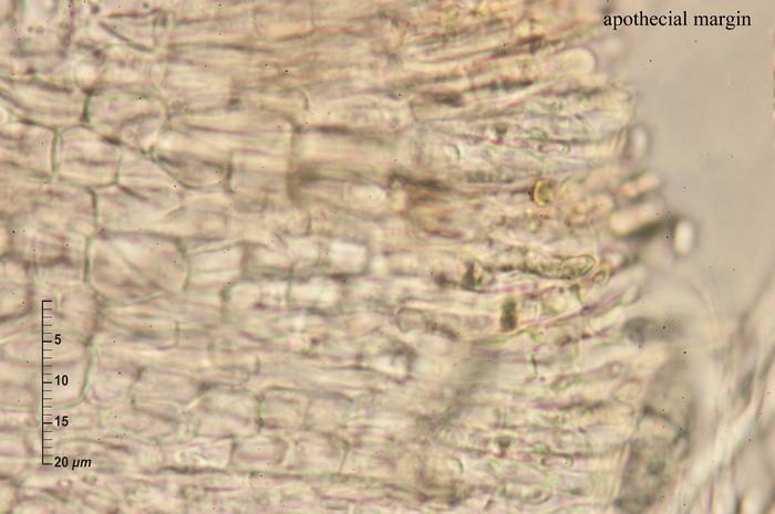 macrostoma