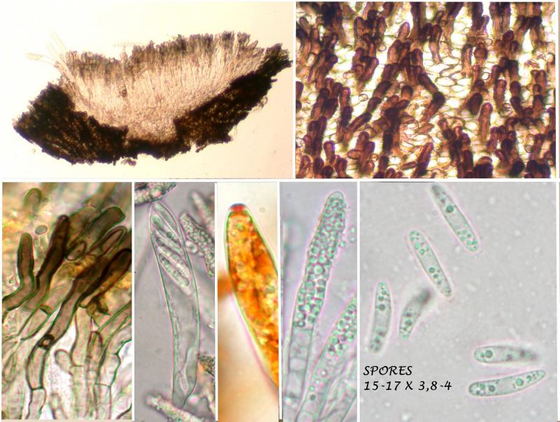 macrostoma