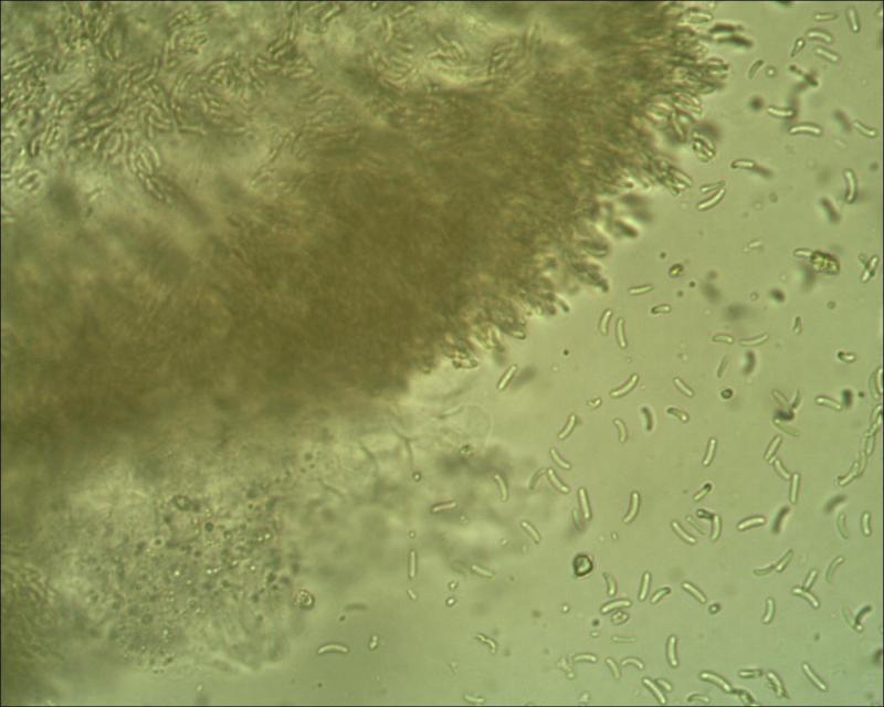 macrostoma