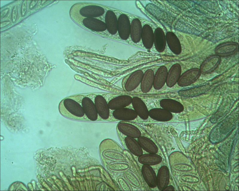macrostoma