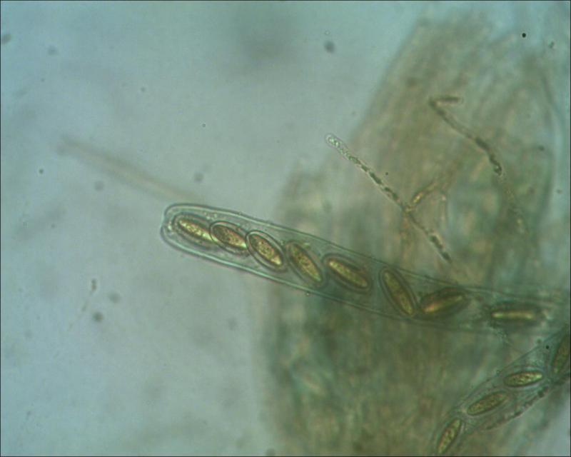 macrostoma