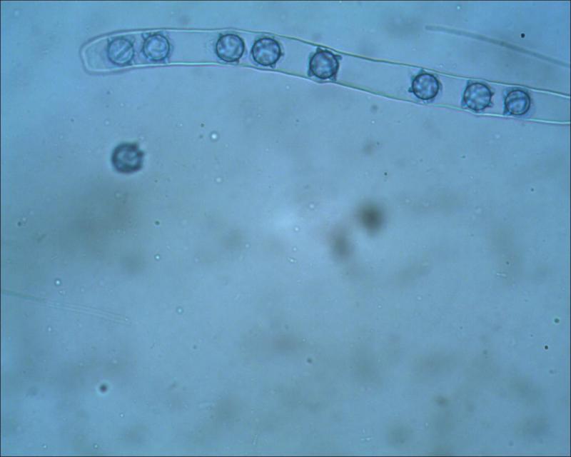 macrostoma