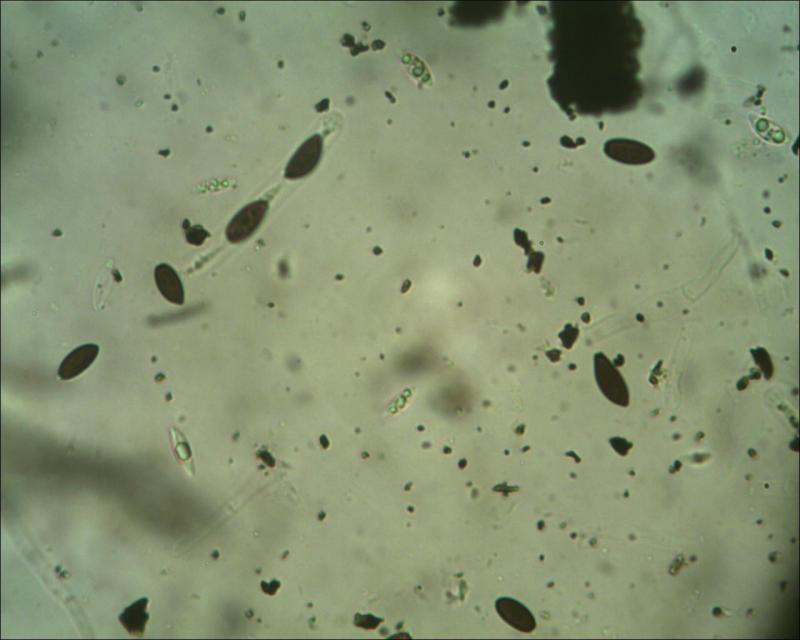 macrostoma