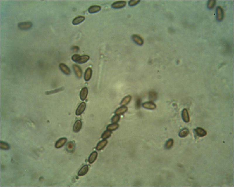 macrostoma