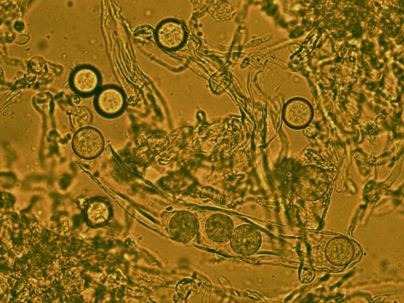 macrostoma