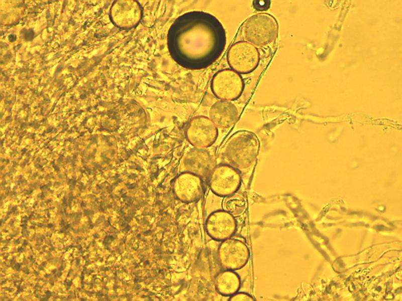 macrostoma