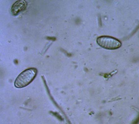 macrostoma