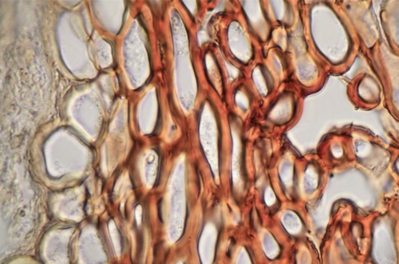 macrostoma