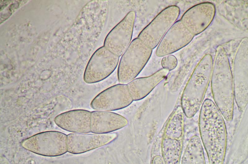 macrostoma