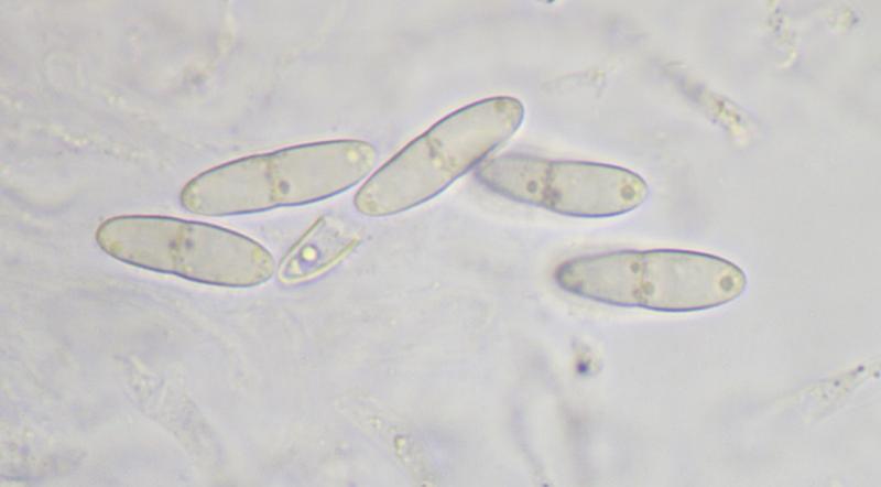 macrostoma