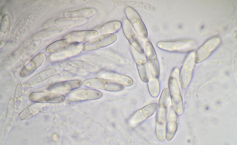 macrostoma
