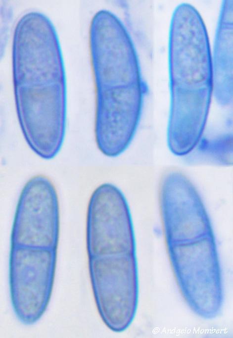 macrostoma
