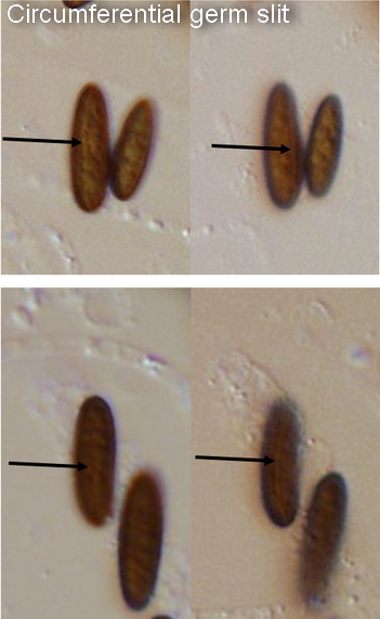 macrostoma