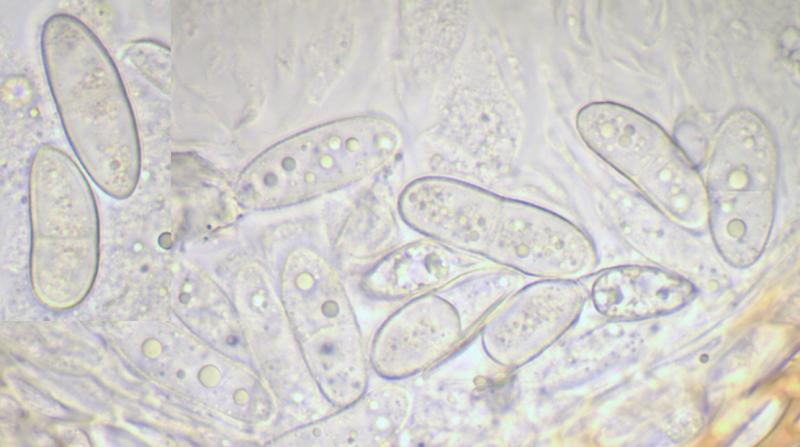 macrostoma