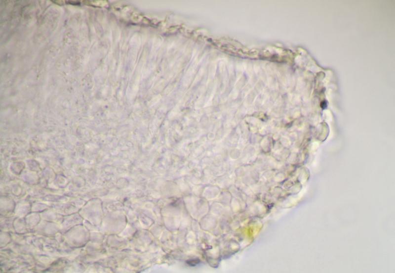macrostoma