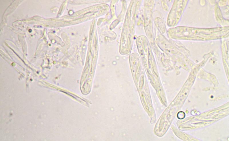 macrostoma