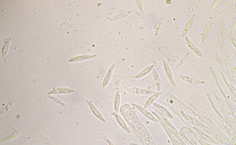 macrostoma