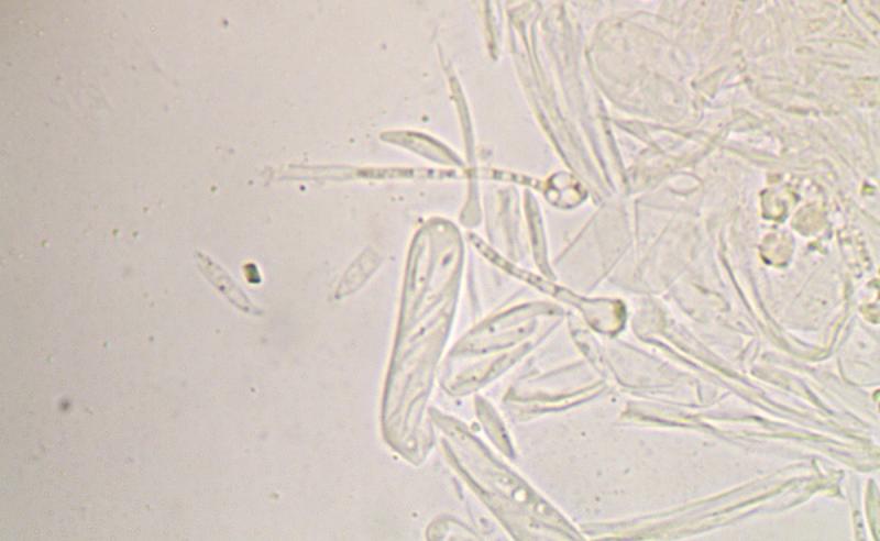 macrostoma