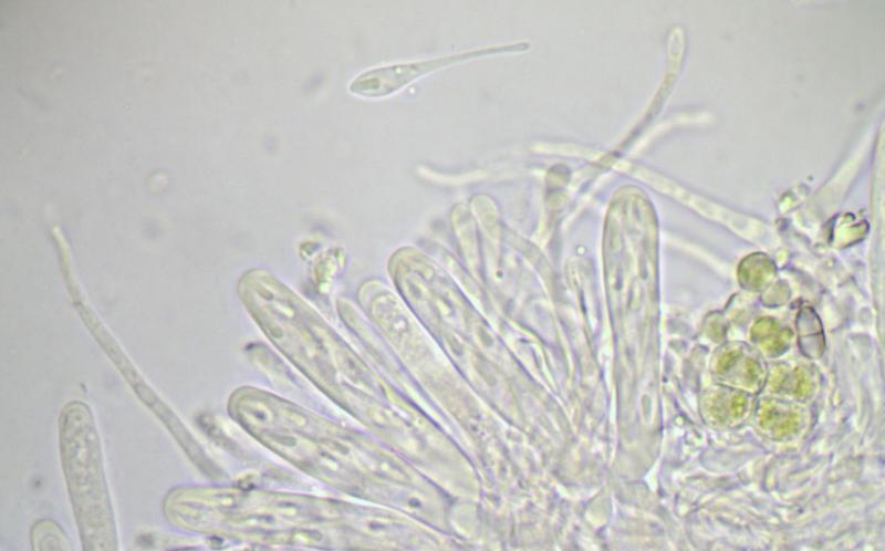 macrostoma