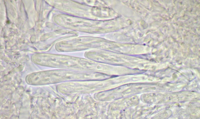macrostoma