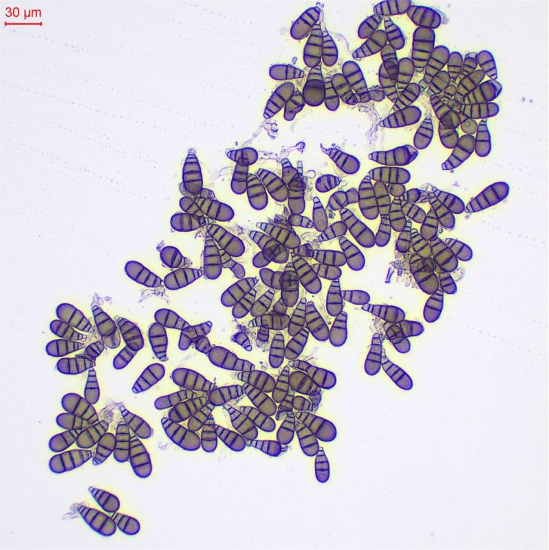 macrostoma