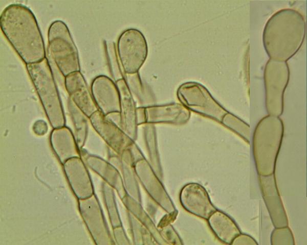 macrostoma