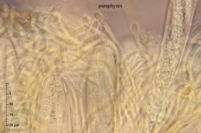 macrostoma